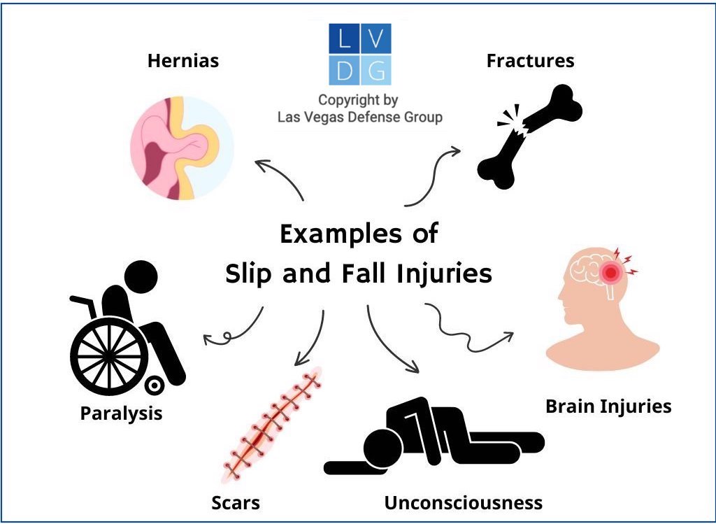 Graphic that shows examples of slip and fall injuries