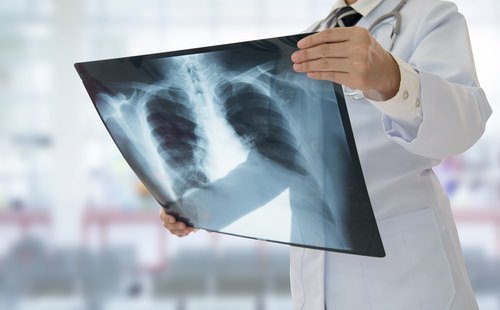 doctor with x-ray